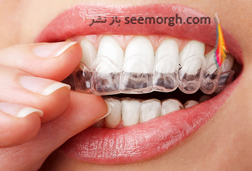 سفید کردن دندان ها با این روش های سالم و ساده